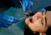 Are Dental Burs the New Beauty Tool? Dental burs